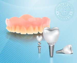 Dental Implants Can Lead To Stable Dentures