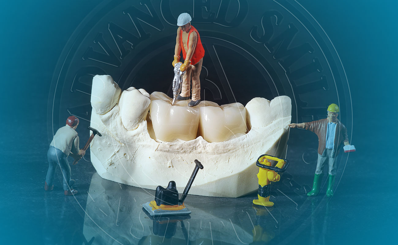 Dental Bridge Dentist in Port St Lucie, FL