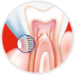 Periodontal Disease Treatment Port St. Lucie, FL